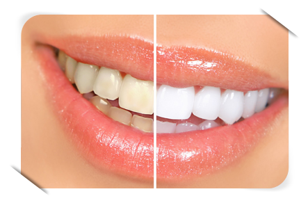 Cosmetic treatment