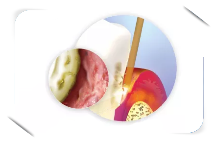 Periodontics